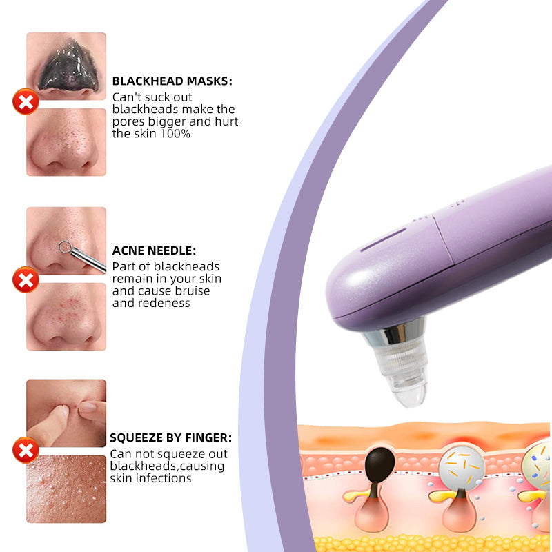Professional 60MPa Blackhead Remover, 3-Speed Adjustable Rechargeable Facial Pore Cleaner with Water Refill  Skincare